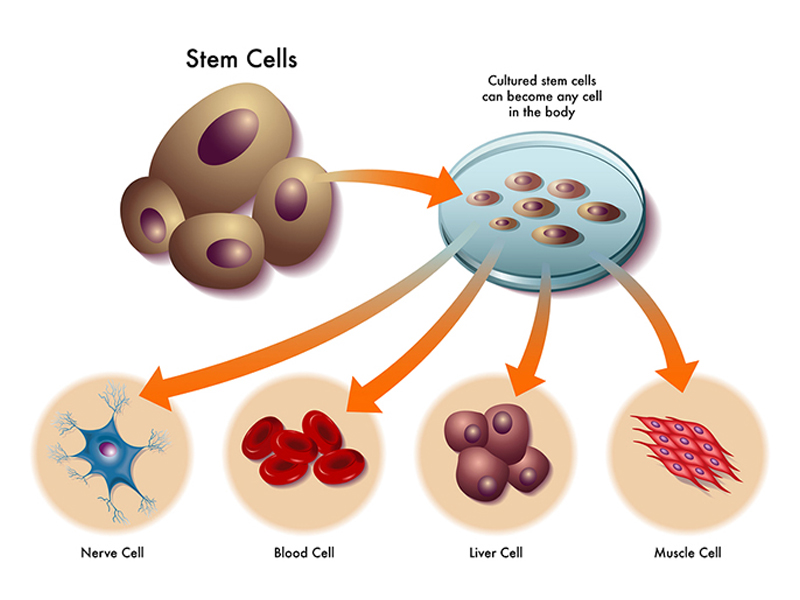 Liệu pháp tế bào gốc là gì?
