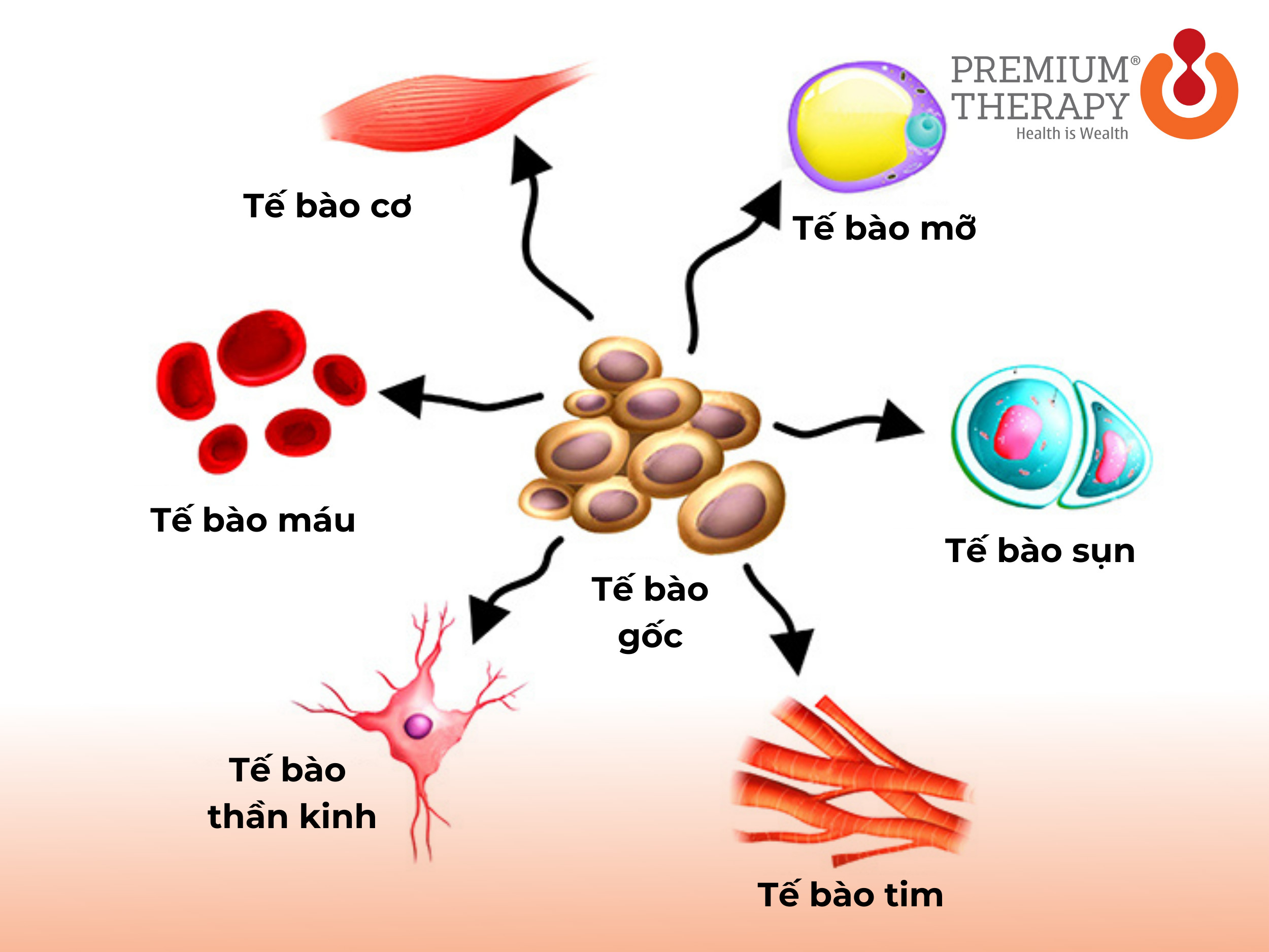 tiêm tế bào gốc